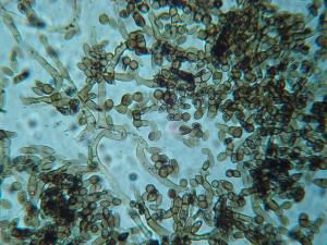Chaetomium Sp